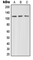 GRM4 / MGLUR4 Antibody - Western blot analysis of mGLUR4 expression in HeLa (A); mouse brain (B); rat brain (C) whole cell lysates.