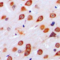 GRM4 / MGLUR4 Antibody - Immunohistochemical analysis of mGLUR4 staining in human brain formalin fixed paraffin embedded tissue section. The section was pre-treated using heat mediated antigen retrieval with sodium citrate buffer (pH 6.0). The section was then incubated with the antibody at room temperature and detected using an HRP conjugated compact polymer system. DAB was used as the chromogen. The section was then counterstained with hematoxylin and mounted with DPX.