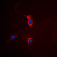 GRM4 / MGLUR4 Antibody - Immunofluorescent analysis of mGLUR4 staining in HeLa cells. Formalin-fixed cells were permeabilized with 0.1% Triton X-100 in TBS for 5-10 minutes and blocked with 3% BSA-PBS for 30 minutes at room temperature. Cells were probed with the primary antibody in 3% BSA-PBS and incubated overnight at 4 C in a humidified chamber. Cells were washed with PBST and incubated with a DyLight 594-conjugated secondary antibody (red) in PBS at room temperature in the dark. DAPI was used to stain the cell nuclei (blue).
