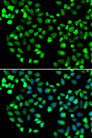 GRM4 / MGLUR4 Antibody - Immunofluorescence analysis of MCF7 cells.