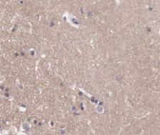 GRM4 / MGLUR4 Antibody - 1:200 staining human brain tissue by IHC-P. The tissue was formaldehyde fixed and a heat mediated antigen retrieval step in citrate buffer was performed. The tissue was then blocked and incubated with the antibody for 1.5 hours at 22°C. An HRP conjugated goat anti-rabbit antibody was used as the secondary.