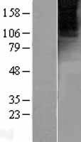 GRM4 / MGLUR4 Protein - Western validation with an anti-DDK antibody * L: Control HEK293 lysate R: Over-expression lysate