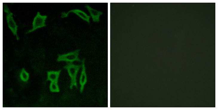 GRM5 / MGLUR5 Antibody - Immunofluorescence analysis of LOVO cells, using GRM5 Antibody. The picture on the right is blocked with the synthesized peptide.