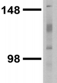GRM5 / MGLUR5 Antibody - Immunoblotting: use at 1ug/ml. A band of ~130kDa is detected. Smaller fragments due to proteolysis are detected as well.
