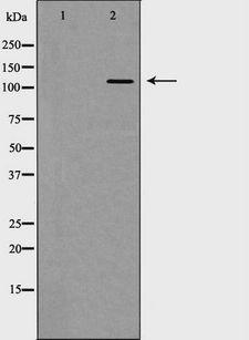 GRM5 / MGLUR5 Antibody - Western blot analysis of GRM5 expression in HT29 cells. The lane on the left is treated with the antigen-specific peptide.