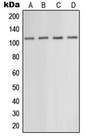 GRM5 / MGLUR5 Antibody - Western blot analysis of mGLUR5 expression in EOC20 (A); mouse liver (B); rat liver (C); rat brain (D) whole cell lysates.