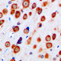 GRM5 / MGLUR5 Antibody - Immunohistochemical analysis of mGLUR5 staining in human brain formalin fixed paraffin embedded tissue section. The section was pre-treated using heat mediated antigen retrieval with sodium citrate buffer (pH 6.0). The section was then incubated with the antibody at room temperature and detected using an HRP conjugated compact polymer system. DAB was used as the chromogen. The section was then counterstained with hematoxylin and mounted with DPX.