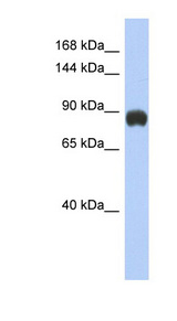 GRM6 / MGLUR6 Antibody - GRM6 / MGLUR6 antibody Western blot of Fetal Small Intestine lysate. This image was taken for the unconjugated form of this product. Other forms have not been tested.