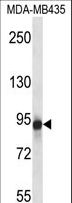 GRM6 / MGLUR6 Antibody - GRM6 Antibody western blot of MDA-MB435 cell line lysates (35 ug/lane). The GRM6 antibody detected the GRM6 protein (arrow).