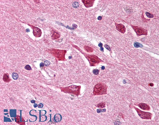 GRM6 / MGLUR6 Antibody - Anti-GRM6 / MGLUR6 antibody IHC of human brain, cortex. Immunohistochemistry of formalin-fixed, paraffin-embedded tissue after heat-induced antigen retrieval. Antibody concentration 5 ug/ml.  This image was taken for the unconjugated form of this product. Other forms have not been tested.