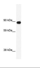 GRM6 / MGLUR6 Antibody - Fetal Brain Lysate.  This image was taken for the unconjugated form of this product. Other forms have not been tested.