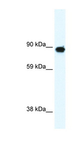 GRM6 / MGLUR6 Antibody - GRM6 / MGLUR6 antibody Western blot of Fetal Brain lysate. This image was taken for the unconjugated form of this product. Other forms have not been tested.