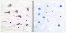 GRM6 / MGLUR6 Antibody - Immunohistochemistry analysis of paraffin-embedded human brain tissue, using mGluR6 Antibody. The picture on the right is blocked with the synthesized peptide.