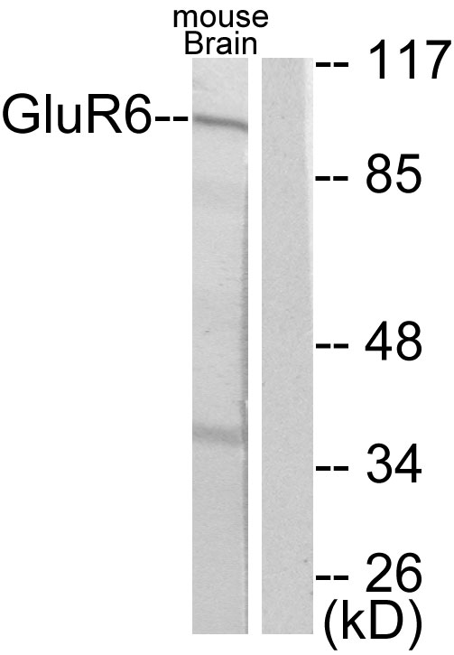 GRM6 / MGLUR6 Antibody - Western blot analysis of lysates from mouse brain, using mGluR6 Antibody. The lane on the right is blocked with the synthesized peptide.