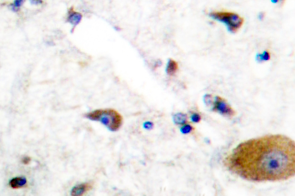 GRM6 / MGLUR6 Antibody - IHC of mGluR6 (A865) pAb in paraffin-embedded human brain tissue.
