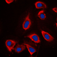 GRM6 / MGLUR6 Antibody - Immunofluorescent analysis of mGLUR6 staining in NIH3T3 cells. Formalin-fixed cells were permeabilized with 0.1% Triton X-100 in TBS for 5-10 minutes and blocked with 3% BSA-PBS for 30 minutes at room temperature. Cells were probed with the primary antibody in 3% BSA-PBS and incubated overnight at 4 C in a humidified chamber. Cells were washed with PBST and incubated with a DyLight 594-conjugated secondary antibody (red) in PBS at room temperature in the dark. DAPI was used to stain the cell nuclei (blue).