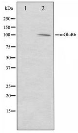 GRM6 / MGLUR6 Antibody - Western blot of mouse brain cell lysate using mGluR6 Antibody