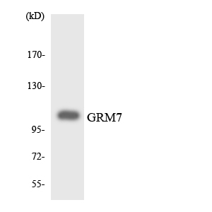 GRM7 / MGLUR7 Antibody - Western blot analysis of the lysates from HUVECcells using GRM7 antibody.