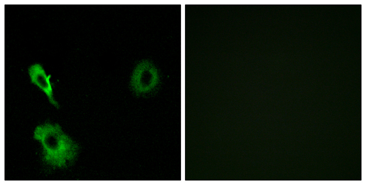 GRM7 / MGLUR7 Antibody - Immunofluorescence analysis of A549 cells, using GRM7 Antibody. The picture on the right is blocked with the synthesized peptide.