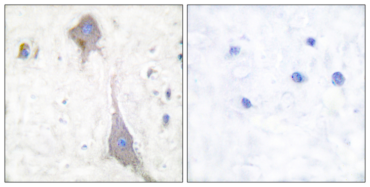 GRM7 / MGLUR7 Antibody - Immunohistochemistry analysis of paraffin-embedded human brain tissue, using mGluR7 Antibody. The picture on the right is blocked with the synthesized peptide.