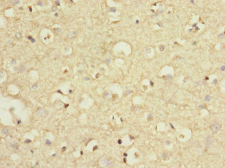 GRM7 / MGLUR7 Antibody - Immunohistochemistry of paraffin-embedded human brain tissue at dilution 1:100