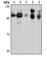 GRM7 / MGLUR7 Antibody - Western blot analysis of mGLUR7 expression in mouse brain (A), rat brain (B), HEK293T (C), Hela (D), MCF7 (E) whole cell lysates.