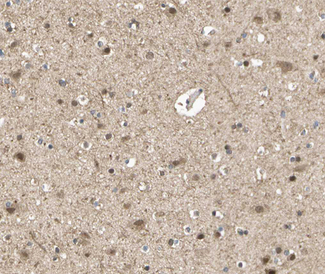 GRM7 / MGLUR7 Antibody - 1:100 staining human brain tissue by IHC-P. The tissue was formaldehyde fixed and a heat mediated antigen retrieval step in citrate buffer was performed. The tissue was then blocked and incubated with the antibody for 1.5 hours at 22°C. An HRP conjugated goat anti-rabbit antibody was used as the secondary.