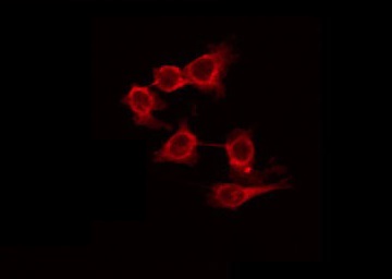 GRM7 / MGLUR7 Antibody - Staining HuvEc cells by IF/ICC. The samples were fixed with PFA and permeabilized in 0.1% Triton X-100, then blocked in 10% serum for 45 min at 25°C. The primary antibody was diluted at 1:200 and incubated with the sample for 1 hour at 37°C. An Alexa Fluor 594 conjugated goat anti-rabbit IgG (H+L) Ab, diluted at 1/600, was used as the secondary antibody.