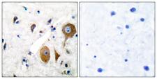 GRM8 / MGLUR8 Antibody - Peptide - + Immunohistochemical analysis of paraffin-embedded human brain tissue using GluR8 antibody.