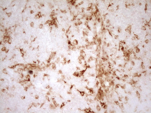 GRN / Granulin Antibody - Immunohistochemical staining of paraffin-embedded Human tonsil within the normal limits using anti-GRN mouse monoclonal antibody. (Heat-induced epitope retrieval by 1 mM EDTA in 10mM Tris, pH8.5, 120C for 3min,