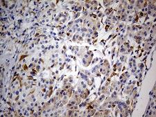 GRN / Granulin Antibody - Immunohistochemical staining of paraffin-embedded Human pancreas tissue within the normal limits using anti-GRN mouse monoclonal antibody. (Heat-induced epitope retrieval by 1mM EDTA in 10mM Tris buffer. (pH8.5) at 120°C for 3 min. (1:500)