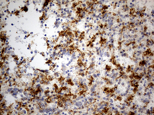 GRN / Granulin Antibody - Immunohistochemical staining of paraffin-embedded Human spleen tissue within the normal limits using anti-GRN mouse monoclonal antibody. (Heat-induced epitope retrieval by Tris-EDTA(1:500)