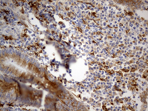 GRN / Granulin Antibody - Immunohistochemical staining of paraffin-embedded Human appendix tissue within the normal limits using anti-GRN mouse monoclonal antibody. (Heat-induced epitope retrieval by Tris-EDTA(1:0)(1:500)