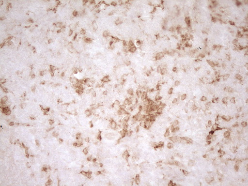 GRN / Granulin Antibody - IHC of paraffin-embedded Human tonsil using anti-GRN mouse monoclonal antibody. (Heat-induced epitope retrieval by 1 mM EDTA in 10mM Tris, pH8.5, 120°C for 3min).