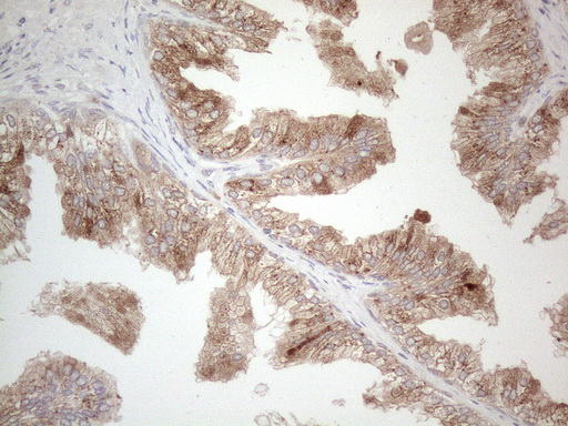 GRN / Granulin Antibody - Immunohistochemical staining of paraffin-embedded Human prostate tissue within the normal limits using anti-GRN mouse monoclonal antibody. (Heat-induced epitope retrieval by 1mM EDTA in 10mM Tris buffer. (pH8.5) at 120°C for 3 min. (1:150)
