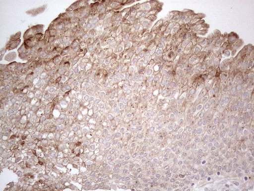 GRN / Granulin Antibody - Immunohistochemical staining of paraffin-embedded Human bladder tissue within the normal limits using anti-GRN mouse monoclonal antibody. (Heat-induced epitope retrieval by 1mM EDTA in 10mM Tris buffer. (pH8.5) at 120°C for 3 min. (1:150)