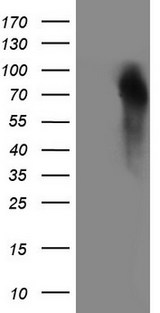 GRN / Granulin Antibody - HEK293T cells were transfected with the pCMV6-ENTRY control. (Left lane) or pCMV6-ENTRY GRN. (Right lane) cDNA for 48 hrs and lysed. Equivalent amounts of cell lysates. (5 ug per lane) were separated by SDS-PAGE and immunoblotted with anti-GRN. (1:2000)