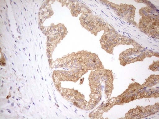 GRN / Granulin Antibody - Immunohistochemical staining of paraffin-embedded Human prostate tissue using anti-GRN mouse monoclonal antibody. (Heat-induced epitope retrieval by 1mM EDTA in 10mM Tris buffer. (pH8.5) at 120°C for 3 min. (1:150)