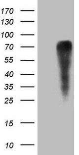 GRN / Granulin Antibody - HEK293T cells were transfected with the pCMV6-ENTRY control. (Left lane) or pCMV6-ENTRY GRN. (Right lane) cDNA for 48 hrs and lysed. Equivalent amounts of cell lysates. (5 ug per lane) were separated by SDS-PAGE and immunoblotted with anti-GRN. (1:2000)