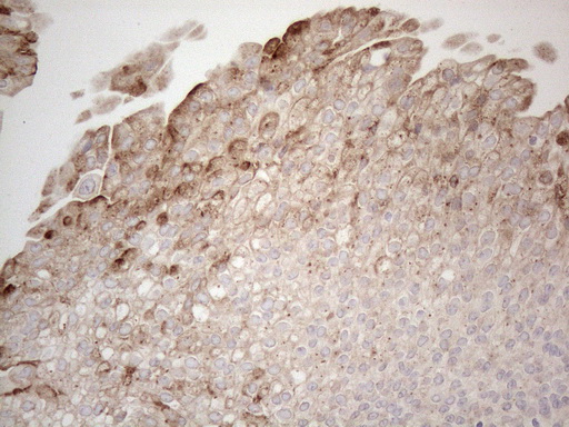 GRN / Granulin Antibody - Immunohistochemical staining of paraffin-embedded Human bladder tissue within the normal limits using anti-GRN mouse monoclonal antibody. (Heat-induced epitope retrieval by 1mM EDTA in 10mM Tris buffer. (pH8.5) at 120°C for 3 min. (1:150)