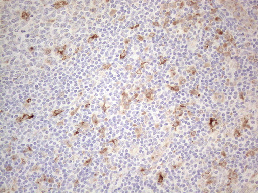 GRN / Granulin Antibody - Immunohistochemical staining of paraffin-embedded Human tonsil within the normal limits using anti-GRN mouse monoclonal antibody. (Heat-induced epitope retrieval by 1mM EDTA in 10mM Tris buffer. (pH8.5) at 120°C for 3 min. (1:150)