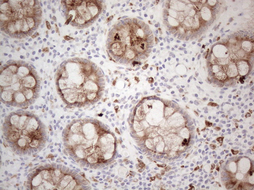 GRN / Granulin Antibody - Immunohistochemical staining of paraffin-embedded Human colon tissue within the normal limits using anti-GRN mouse monoclonal antibody. (Heat-induced epitope retrieval by 1mM EDTA in 10mM Tris buffer. (pH8.5) at 120°C for 3 min. (1:150)
