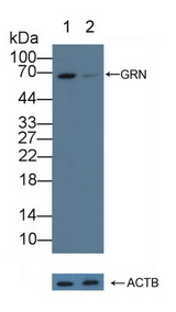 GRN / Granulin Antibody - Knockout Varification: Lane 1: Wild-type A431 cell lysate; Lane 2: GRN knockout A431 cell lysate; Predicted MW: 44,47,64kd Observed MW: 64kd Primary Ab: 1µg/ml Rabbit Anti-Human GRN Antibody Second Ab: 0.2µg/mL HRP-Linked Caprine Anti-Rabbit IgG Polyclonal Antibody