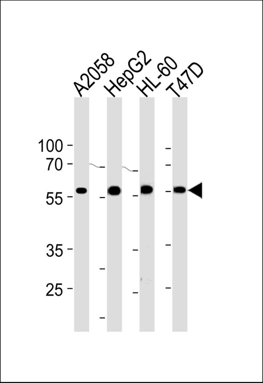 GRN / Granulin Antibody - GRN Antibody western blot of A2058,HepG2,HL-60,T47D cell line lysates (35 ug/lane). The GRN antibody detected the GRN protein (arrow).