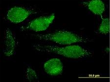 GRN / Granulin Antibody - Immunofluorescence of monoclonal antibody to GRN on HeLa cell. [antibody concentration 10 ug/ml]