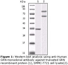 GRN / Granulin Antibody
