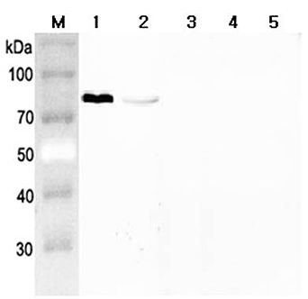 GRN / Granulin Antibody - Western blot analysis using anti-Progranulin (mouse), pAb at 1:2000 dilution. 1: Mouse Progranulin (FLAG-tagged). 2: Human Progranulin (FLAG-tagged). 3: Human Granulin C (FLAG-tagged). 4: Human Granulin F (FLAG-tagged). 5: Human ANGPTL3 (FLAG-tagged) (negative control).