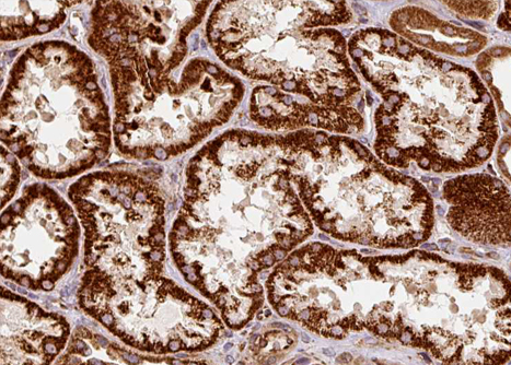 GRN / Granulin Antibody - 1:100 staining human kidney tissue by IHC-P. The sample was formaldehyde fixed and a heat mediated antigen retrieval step in citrate buffer was performed. The sample was then blocked and incubated with the antibody for 1.5 hours at 22°C. An HRP conjugated goat anti-rabbit antibody was used as the secondary.