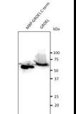 GroEL Antibody - Anti-GroEL antibody 1:500 dilution. 50 ug of recombinant protein or 100 ug of total protein (Burkholderia) per lane. Rabbit polyclonal to goat IgG (HRP) at 1:10000 dilution.