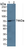 Growth Hormone Receptor / GHR Antibody - Western Blot; Sample: Lane1: Mouse Liver Tissue; Lane2: Rat Liver Tissue.